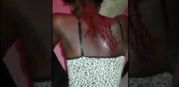 VIOLENCES CONJUGALES À TOUBA: Bara Sow bastonne son épouse de 18 ans avec un fil electrique