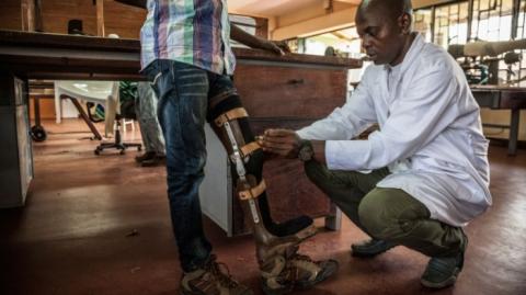 STIGMATISATION, MANQUE D’ASSISTANCE PSYCHOLOGIQUE, OUBLI: A Ziguinchor, les victimes de mines parlent de leurs difficiles conditions de vie