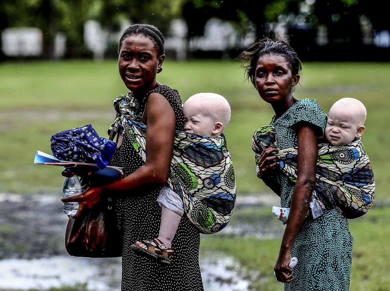 L’EXPERTE DES NATIONS-UNIES SUR LES CONSEQUENCES DU COVID-19 SUR L’ALBINISME EN AFRIQUE Les meurtres de personnes atteintes d’albinisme ont augmenté pendant la pandémie