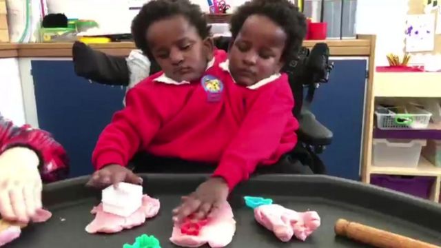 4 ANS APRES LEUR NAISSANCE Les siamoises Ndèye et Marème en préscolaire à Cardiff apprennent à marcher… leur papa entre joie et crainte