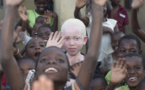 VIOLENCE TOUT COURT OU VIOLENCES ELECTORALES:  Amnesty International veut éviter que les albinos soient victimes de sacrifices humains